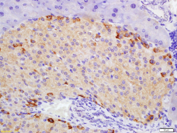 ATG1/ULK1 Rabbit Polyclonal Antibody