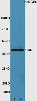 ATG4D Rabbit Polyclonal Antibody