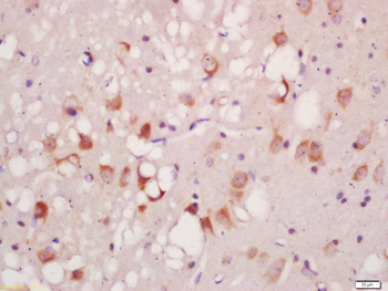 Phospho-ATG1 (Ser556) Rabbit Polyclonal Antibody