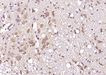 ATG18 Rabbit Polyclonal Antibody