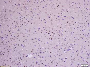 Phospho-Beta-Catenin (Ser33 + Ser37) Rabbit Polyclonal Antibody