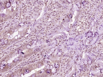 Phospho-Beta Catenin (Ser675) Rabbit Polyclonal Antibody