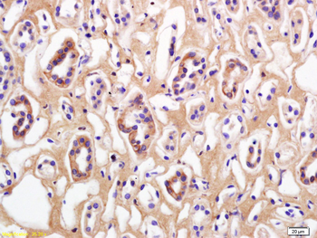 Phospho-Beta Catenin (Thr41 + Ser45) Rabbit Polyclonal Antibody