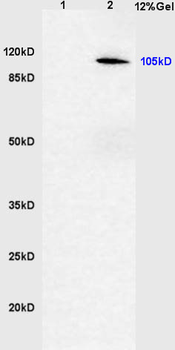 Phospho-CYLD (Ser418) Rabbit Polyclonal Antibody