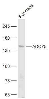 ADCY5 Rabbit Polyclonal Antibody