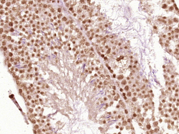 Phospho-CDK1 (Thr14) Rabbit Polyclonal Antibody