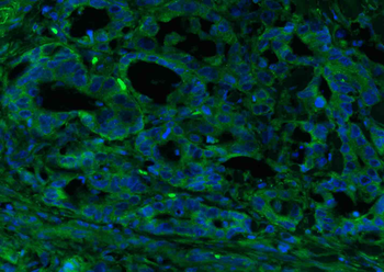 CEA Rabbit Polyclonal Antibody