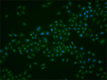 PBK Rabbit Polyclonal Antibody