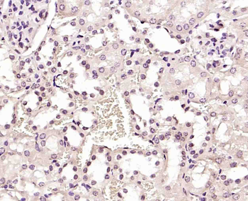 Phospho-HER4 (Tyr984) Rabbit Polyclonal Antibody