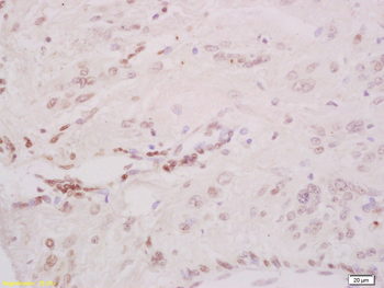 Phospho-CHEK2 (Thr68) Rabbit Polyclonal Antibody