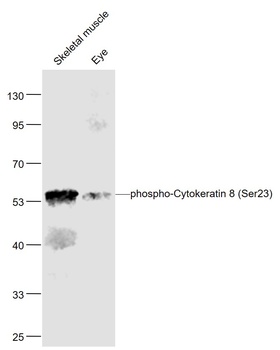 CK8 (phospho-Ser23) antibody