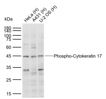 Cytokeratin 17 (phospho-Ser44) antibody