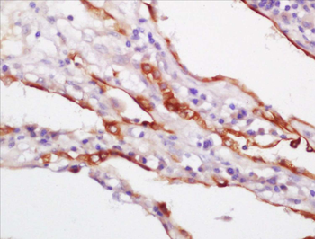 CK18 Rabbit Polyclonal Antibody