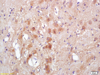 CKMT2 Rabbit Polyclonal Antibody