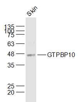 GTPBP10 Rabbit Polyclonal Antibody