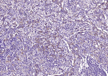 CLEC5A Rabbit Polyclonal Antibody