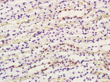 COX1/MTCO1 Rabbit Polyclonal Antibody