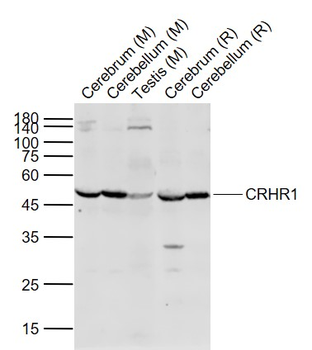 CRHR1 Rabbit Polyclonal Antibody