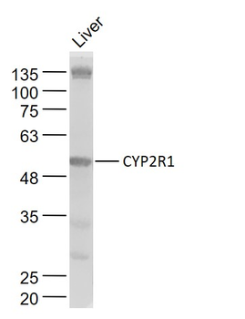 CYP2R1 Rabbit Polyclonal Antibody