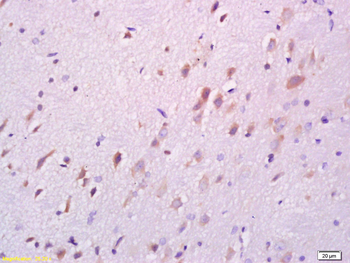 DARPP32 Rabbit Polyclonal Antibody