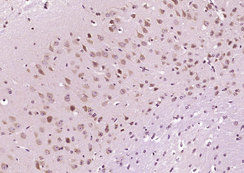 DIO2 Rabbit Polyclonal Antibody