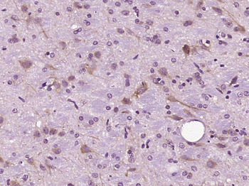 DIO2 Rabbit Polyclonal Antibody