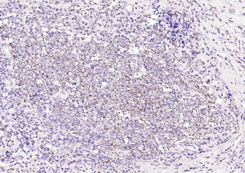 DIO2 Rabbit Polyclonal Antibody