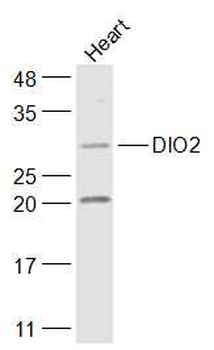 DIO2 Rabbit Polyclonal Antibody
