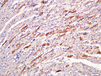 DMT1 Rabbit Polyclonal Antibody