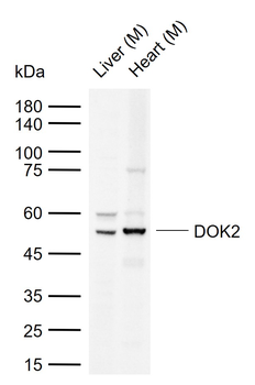 DOK2 Rabbit Polyclonal Antibody