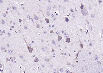 LPAR3 Rabbit Polyclonal Antibody