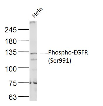 Phospho-EGFR (Ser991) Rabbit Polyclonal Antibody