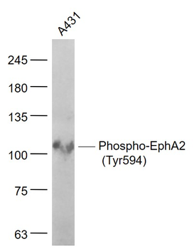 Phospho-EphA2 (Tyr594) Rabbit Polyclonal Antibody