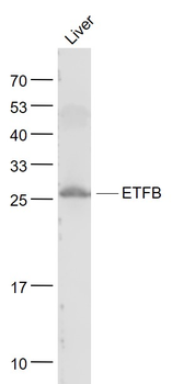 ETFB Rabbit Polyclonal Antibody