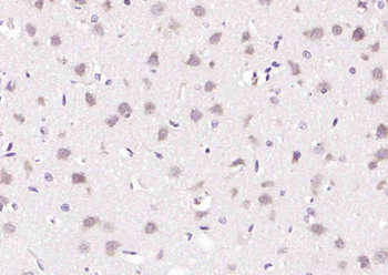Phospho-FLG (Tyr766) Rabbit Polyclonal Antibody