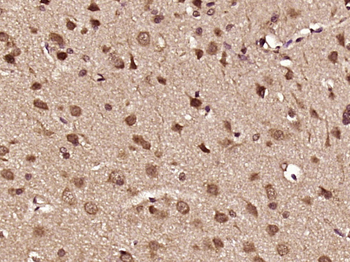 Phospho-PYK2 (Tyr881) Rabbit Polyclonal Antibody