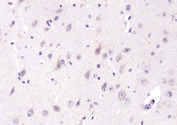 PLC gamma 1 (phospho-Tyr771) antibody