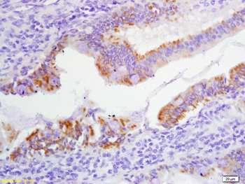 Phospho-FHIT (Tyr114) Rabbit Polyclonal Antibody