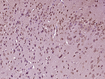 FOXO4 Rabbit Polyclonal Antibody