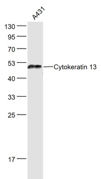 Cytokeratin 13 Rabbit Polyclonal Antibody