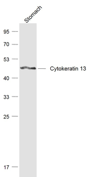 Cytokeratin 13 Rabbit Polyclonal Antibody