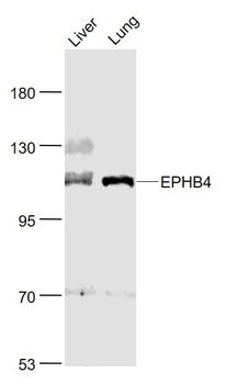 EPHB4 Rabbit Polyclonal Antibody