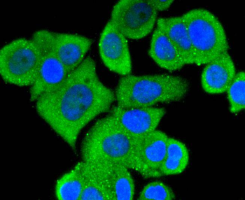 MEKK3 Recombinant Rabbit Monoclonal Antibody