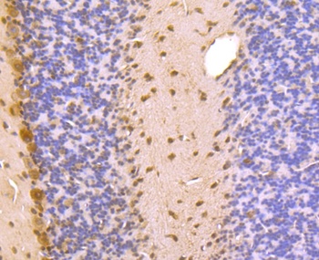 PSMA1 antibody