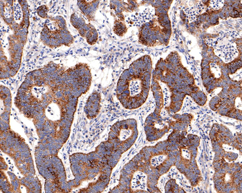 IKK gamma Recombinant Rabbit Monoclonal Antibody