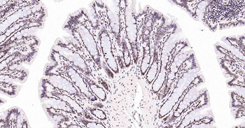 Rad51 Recombinant Rabbit Monoclonal Antibody