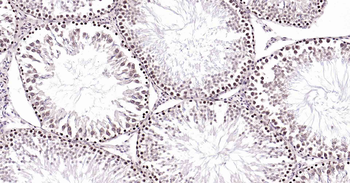Rad51 Recombinant Rabbit Monoclonal Antibody