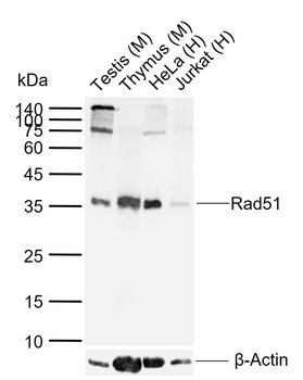 Rad51 Recombinant Rabbit Monoclonal Antibody