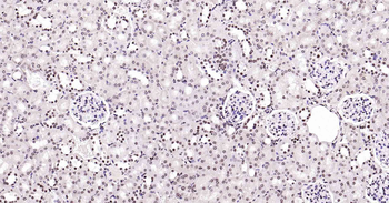 Rad51 Recombinant Rabbit Monoclonal Antibody