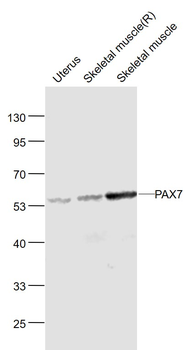 PAX7 Rabbit Polyclonal Antibody